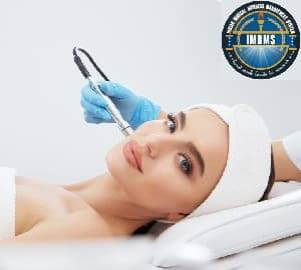 Microdermabrasion treatment