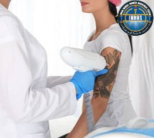 Laser tattoo removal treatment