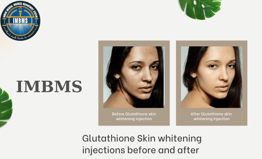 Glutathione Skin whitening injections before and after