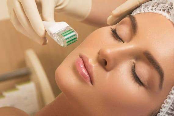 Derma Roller treatment